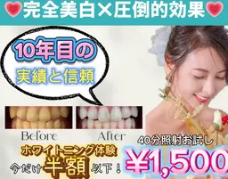 【いい歯の日🦷】11/8まで限定✨️美白セルフホワイトニング たっぷり40分照射¥7,980⇒¥1,500