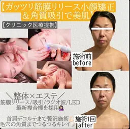 🌟成人式応援クーポン🌟新成人応援📣成人式前のスペシャル小顔ケア💆‍♀️