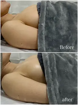 バストケア全身オールハンド