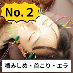 【12月限定☆小顔】美容鍼+首マッサージ+ヘッドスパ ¥12,000→¥4,980