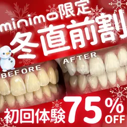 【minimo限定❤️冬直前割❤️】8分照射×2回の大人気定番メニュー💎ホワイトニングデビューはここから🔰✨