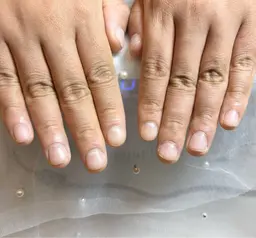 【深爪・噛み爪】