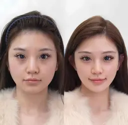 本格韓国コルギ小顔60分+アロマオイルリンパマッサージ60分  120分