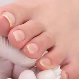 フットオフ