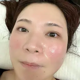 ハリや弾力UP！シワやたるみを予防☺️＼プラズマシャワー×高濃度美容液フェイシャル／エイジングケアメニューです❤️