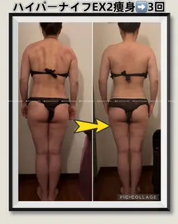結果NO1【年齢による頑固贅肉お悩み方】新型ハイパーナイフEX上or下半身痩身&お腹下腹脂肪60分18000