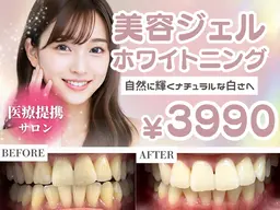★この料金で試せるのはこれが最後★10名限定美容ホワイトニング15分×4照射