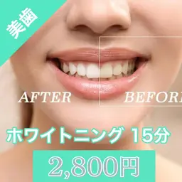 🦷セルフホワイトニング✨LED照射15分／¥1,000（税込）痛みなし◎まずはお試しにぴったり🌟