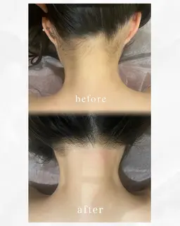 人気メニュー♪アップにする方必見☺️自分じゃ出来ないうなじ脱毛🌟こちらでシェービング致します！3回コース7700円！