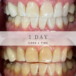 【しっかり42分照射:7min×6set】+.｡:HAHAHAお試し価格ﾟ+:｡.