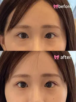 ラッシュリフト【上のみ】アイシャンプー付き🧴🫧