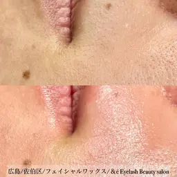 ご新規様、半年以上ご来店がない方限定！フェイシャルWAX全顔￥8,800→￥6,800⚠️注意事項要確認⚠️
