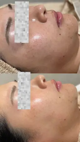 初回フェイシャル スペシャルケア