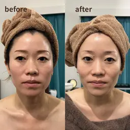 マッサージ➕クレイパック🌈100%天然シリカブラック独占配合❣️老廃物を出し、ミネラル補給✨【肌荒れ・くすみ・むくみ】