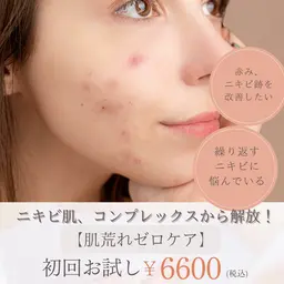 【ブツブツ・肌荒れから解放】１回目から効果を実感！“肌荒れゼロケア”