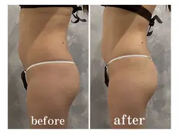 【男女】新生活に変化を【筋膜リリース全身痩身90分】¥18000→¥11000