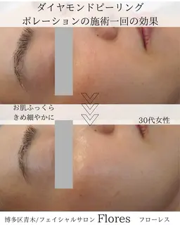 ＼リピーター様限定クーポン／人気の60分フェイシャルに【クイックヘッドマッサージ付き】でお得にご案内💗