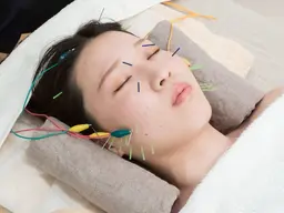 【美容鍼お試しコース】初めての方でも安心🎀痛みの少ないクイック電気美容鍼60分¥9,900→¥3,900