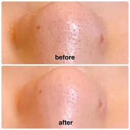 🆕お肌ツルツル化粧ノリ抜群🥚✨毛穴洗浄✨