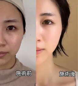 初回限定:韓国最新美容エステ