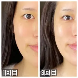 剥離なしハーブピーリング【お肌が生まれ変わる】