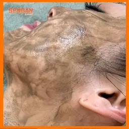 ★17 ハーブピーリング(剥離)Lv.2 90分 28000円→75%off