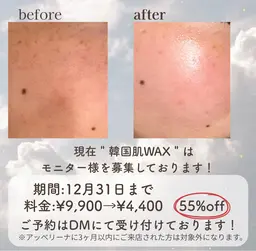 《毛穴汚れ・ざらつき撃退》美肌フェイシャルwax✨