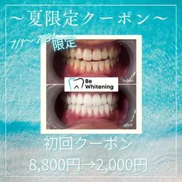 🌻夏限定クーポン🌻15分×2回照射　2,000円