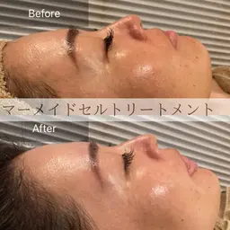 脳洗浄ヘッドマッサージ90分(17000円)✖️マーメイドセルトリートメント(16500円)
