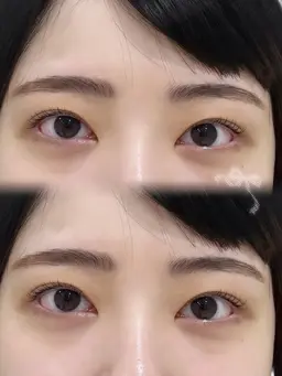 [平日限定💫]・上まつ毛パーマ🎀コーティング仕上げ&アイシャンプー🪄