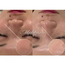 【モニター募集🧖🏻♀️】《乾燥にお悩みの方》お肌ダメージ修復ケア *1日2名限定* 通常価格¥5,800→