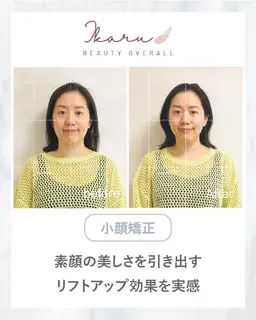 【初回体験】小顔かっさ＋小顔矯正＋ヘッドスパ＋顎関節調整（45分）  ¥9000→¥5000