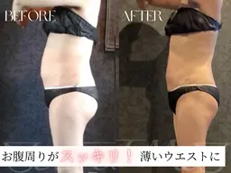 初回体験【セルフ痩身｜1部位30分】最先端痩身マシンが当て放題🔥ダイエット/冷えむくみ緩和　¥3500→¥1100