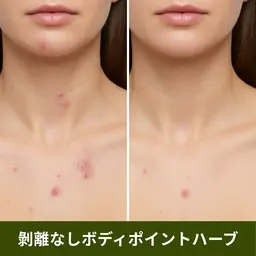 【ポイント施術】ボディハーブピーリング(剥離なし)ヒト幹細胞培養上清液入りハーブ🌿お尻/背中上or下/デコルテ/足/腕