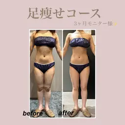 🩵平日予約限定🩵下半身集中で足痩せで自信を🌟エステでしかできないケアでセルライトのない最強美脚を手に入れよう💓
