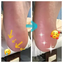 足トータルケアコース(足の爪カット、甘皮ケア、爪表面のピカピカ仕上げ、タコ•魚の目•角質除去)