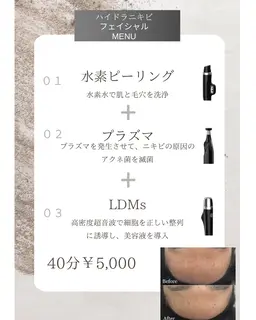 先着10名様限定🤍地域初韓国肌管理美容機器❕ニキビフェイシャルコース