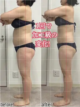 痛くない！歪みも癒しも痩身も👍️軟部組織リリース