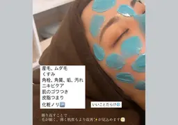 【​9月限定🌈】フェイス脱毛WAX＋眉毛ワックス脱毛(黄金比スタイリング有)＋シートパック