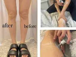 モデル価格！インディバを使用した美脚ケア　(フットケア、フットシャンプー、炭酸パック、インディバ、マッサージ)