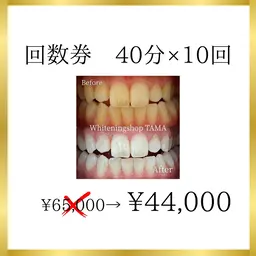 ミニモ限定【最初が肝心♪しっかりトーンアップ】回数券40分×10回(10来店)¥44,000