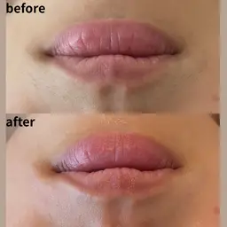 【モニター募集】フェイスワックス ヒト幹細胞高保湿パック付き