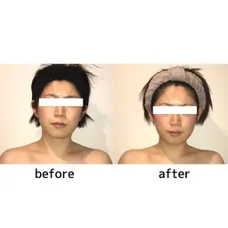 【こりとりコルギ】身体から徹底ほぐし❣️結果重視の本格コルギ✦速攻スッキリ小顔💆‍♀️✨