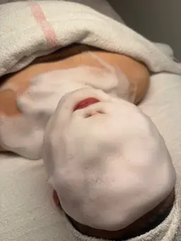 美白、美肌、シミ、くすみには欠かせないスーパー成分を贅沢に！！日焼け後のケアにも◎グルタチオン濃密泡白玉パック