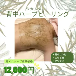 【練習モデル】背中ハーブピーリング7000円