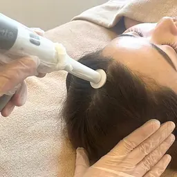 プロセルセラピーズ‐頭皮トリートメント‐※モニター様