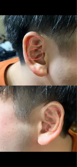 【12個】耳ツボ(ジュエリーなし)