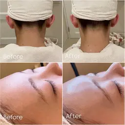 💎フェイス&うなじシェービング💎