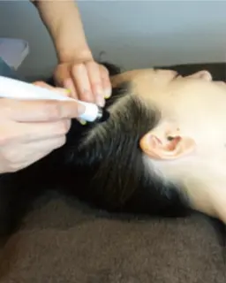 初体感！濡れない頭皮炭酸洗浄&吸引！30分