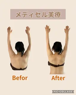 筋膜リリース専用機器による全身可動域拡大をサポート！